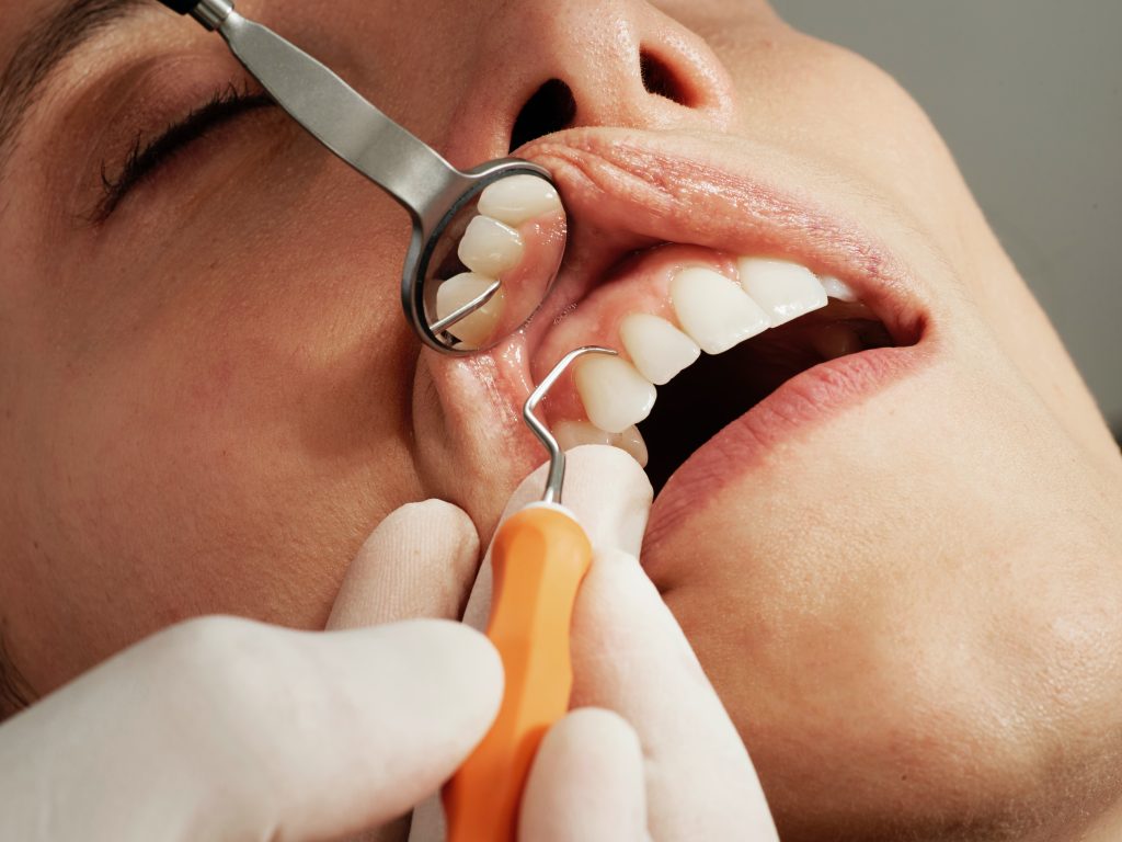 tratamento odontológico