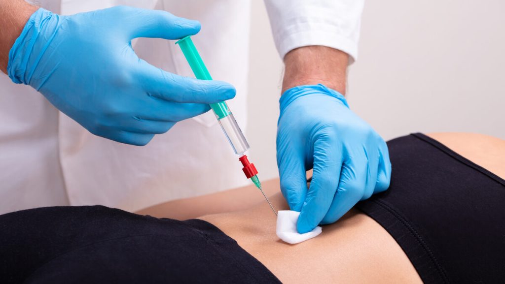 Terapia de Ozônio